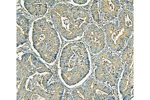 IHC analysis of MVP using anti-MVP antibody (ABIN7600481).