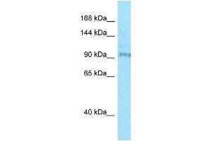 WB Suggested Anti-BBS9 Antibody Titration: 1. (BBS9 Antikörper  (N-Term))