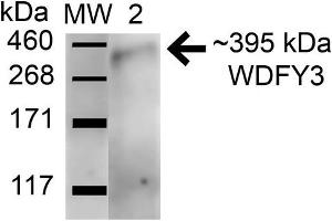 Western blot analysis of Human HeLa and 293Trap cell lysates showing detection of 395. (WDFY3 Antikörper  (AA 533-544) (Atto 488))