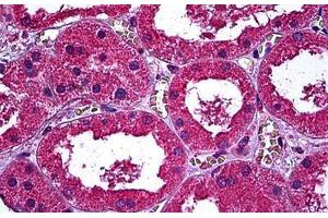 Human Kidney: Formalin-Fixed, Paraffin-Embedded (FFPE) (ERBB3 Antikörper  (AA 21-332))