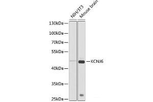 Western blot analysis of extracts of various cell lines using KCNJ6 Polyclonal Antibody at dilution of 1:1000. (KCNJ6 Antikörper)