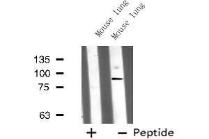 Western blot analysis of DDX50 expression in Mouse lung lysate (DDX50 Antikörper  (C-Term))