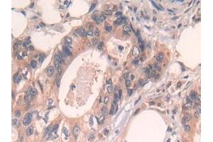 Immunohistochemistry (IHC) image for anti-P450 (Cytochrome) Oxidoreductase (POR) (AA 77-518) antibody (ABIN7435475)