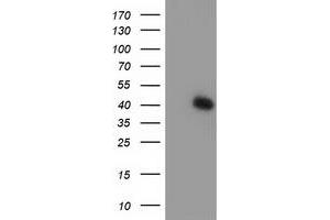 Western Blotting (WB) image for anti-TBC1 Domain Family, Member 21 (TBC1D21) antibody (ABIN1501315) (TBC1D21 Antikörper)