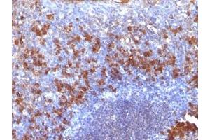 Formalin-fixed, paraffin-embedded human tonsil stained with biotinylated Lambda Light Chain Ab probe followed by anti-Biotin antibody (SPM375).