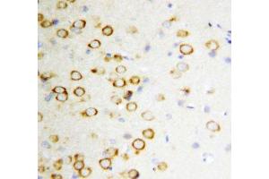 IHC-P: GDNF antibody testing of rat brain tissue (GDNF Antikörper  (Middle Region))