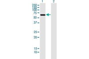 Western Blotting (WB) image for anti-Achalasia, Adrenocortical Insufficiency, Alacrimia (AAAS) (AA 1-100) antibody (ABIN563541)