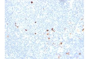 Formalin-fixed, paraffin-embedded human tonsil stained with IgM Recombinant Mouse Monoclonal Antibody (rIGHM/1623). (Rekombinanter IGHM Antikörper)
