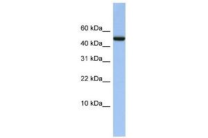 WB Suggested Anti-ABAT Antibody Titration: 0. (ABAT Antikörper  (Middle Region))