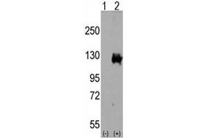 Western blot analysis of TRPM8 antibody and 293 cell lysate either nontransfected (Lane 1) or transiently transfected with the TRPM8 gene (2). (TRPM8 Antikörper  (AA 1075-1104))