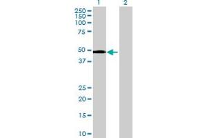 Western Blot analysis of SNRNP48 expression in transfected 293T cell line by SNRNP48 MaxPab polyclonal antibody. (SNRNP48 Antikörper  (AA 1-339))
