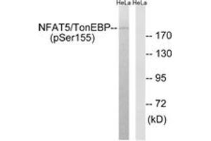 Western blot analysis of extracts from HeLa cells treated with forskolin 40nM 30', using NFAT5/TonEBP (Phospho-Ser155) Antibody. (NFAT5 Antikörper  (pSer155))
