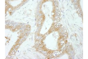 Immunohistochemistry (IHC) image for anti-Flightless I Homolog (FLII) (AA 425-475) antibody (ABIN7448968) (FLII Antikörper  (AA 425-475))