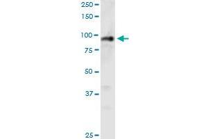 PHC1 monoclonal antibody (M05), clone 3G1. (PHC1 Antikörper  (AA 751-851))