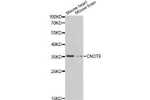 Western blot analysis of extracts of various cell lines, using CNOT8 Antibody. (CNOT8 Antikörper)