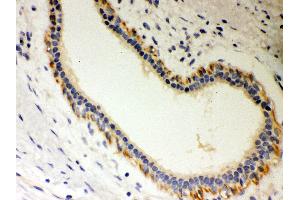 Immunohistochemistry (IHC) image for anti-Serine/threonine Kinase Receptor Associated Protein (STRAP) (AA 78-104), (N-Term) antibody (ABIN3043302)