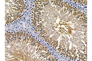 ABIN6257498 and ABIN6275600 at 1/100 staining rat testis tissue by IHC-P. (Sorting Nexin 1 Antikörper  (Internal Region))
