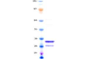 Western Blotting (WB) image for Kallikrein 2 (KLK2) (Transcript Variant 1) protein (Myc-DYKDDDDK Tag) (ABIN2712308)
