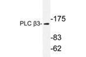 Western blot analysis of PLC β3 antibody in extracts from HeLa cells.