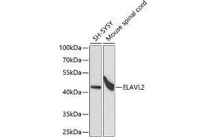 Western blot analysis of extracts of various cell lines, using EL antibody (ABIN6134649, ABIN6140114, ABIN6140116 and ABIN6221621) at 1:1000 dilution. (ELAVL2 Antikörper  (AA 1-100))