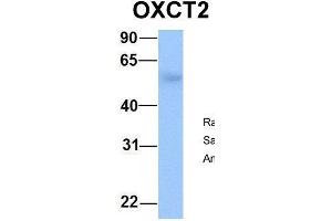 Host:  Rabbit  Target Name:  OXCT2  Sample Type:  Human Fetal Lung  Antibody Dilution:  1. (OXCT2 Antikörper  (Middle Region))