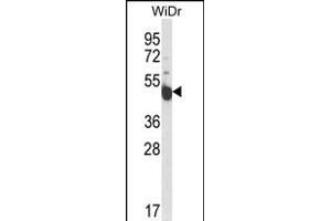 Western blot analysis of INSC Antibody (Center) (ABIN653657 and ABIN2842997) in WiDr cell line lysates (35 μg/lane).