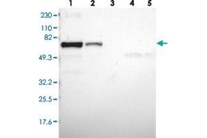 Western blot analysis of Lane 1: RT-4, Lane 2: U-251 MG, Lane 3: Human Plasma, Lane 4: Liver, Lane 5: Tonsil with CD2AP polyclonal antibody  at 1:250-1:500 dilution. (CD2AP Antikörper)
