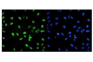 IF analysis of U2AF2 using anti-U2AF2 antibody (ABIN7600793).