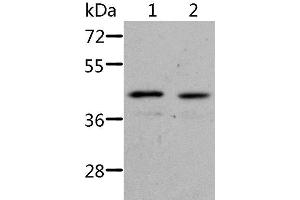 Western Blot analysis of Jurkat cell and Human fetal kidney tissue using NIF3L1 Polyclonal Antibody at dilution of 1:500 (NIF3L1 Antikörper)