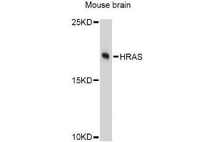 Western blot analysis of extracts of mouse brain, using HRAS Antibody. (HRAS Antikörper  (AA 1-189))