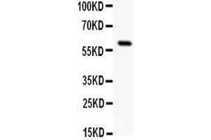 Anti-SSTR1 antibody, Western blotting All lanes: Anti SSTR1  at 0. (SSTR1 Antikörper  (C-Term))
