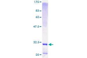 Image no. 1 for Defensin, beta 1 (DEFB1) (AA 1-68) protein (GST tag) (ABIN1351416)