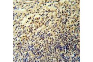 Immunohistochemistry analysis in tonsil (Formalin-fixed, Paraffin-embedded) using PLA2G7 Antibody , followed by peroxidase conjugated secondary antibody and DAB staining. (PLA2G7 Antikörper  (Middle Region))