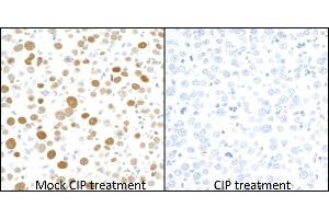 Immunohistochemistry (IHC) image for anti-Minichromosome Maintenance Complex Component 2 (MCM2) (pSer53) antibody (ABIN7449430) (Rekombinanter MCM2 Antikörper  (pSer53))