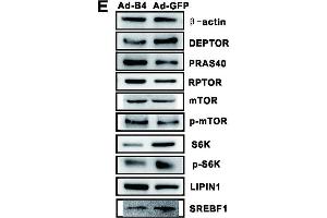 Western Blotting (WB) image for anti-Mechanistic Target of Rapamycin (serine/threonine Kinase) (mTOR) (C-Term) antibody (ABIN2855088)