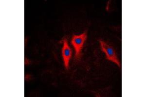 Immunofluorescent analysis of Cytokeratin 5 staining in HeLa cells. (Cytokeratin 5 Antikörper  (C-Term))