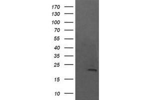 Image no. 1 for anti-NFKB Inhibitor Interacting Ras-Like 1 (NKIRAS1) antibody (ABIN1499741) (NKIRAS1 Antikörper)