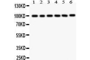 Anti- STIM1 Picoband antibody, Western blotting All lanes: Anti STIM1  at 0. (STIM1 Antikörper  (N-Term))