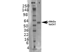 Western Blot analysis of Rat brain membrane lysate showing detection of VAChT protein using Mouse Anti-VAChT Monoclonal Antibody, Clone S6-38 . (SLC18A3 Antikörper  (AA 521-532) (FITC))