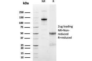 SDS-PAGE Analysis Purified FCGRT Mouse Monoclonal Antibody (FCGRT/2932). (FcRn Antikörper  (AA 24-215))