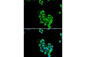 Immunofluorescence analysis of U2OS cells using JADE1 antibody (ABIN5973751). (PHF17 Antikörper)