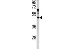Western blot analysis of ANGPTL7 antibody and HeLa lysate. (ANGPTL7 Antikörper  (AA 74-104))