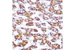 Immunohistochemistry of paraffin-embedded human liver using IDO1 Rabbit mAb (ABIN7267863) at dilution of 1:100 (40x lens). (IDO1 Antikörper)