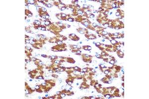 Immunohistochemistry of paraffin-embedded human liver using IDO1 Rabbit mAb (ABIN7267863) at dilution of 1:100 (40x lens).