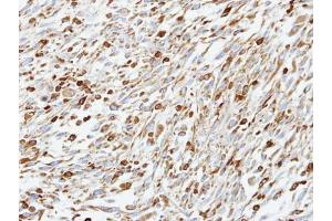 IHC-P Image Immunohistochemical analysis of paraffin-embedded C2C12 xenograft, using CoCoA, antibody at 1:100 dilution. (CALCOCO1 Antikörper)
