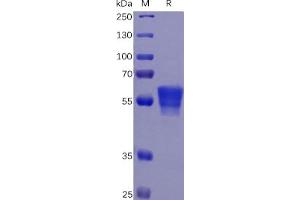 Human CD7 Protein, mFc Tag on SDS-PAGE under reducing condition. (CD7 Protein (CD7) (mFc Tag))