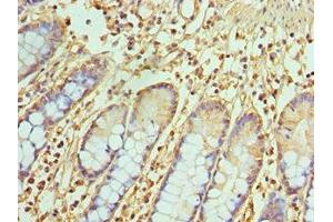 Immunohistochemistry of paraffin-embedded human small intestine tissue using ABIN7172071 at dilution of 1:100 (TREX1 Antikörper  (AA 1-270))