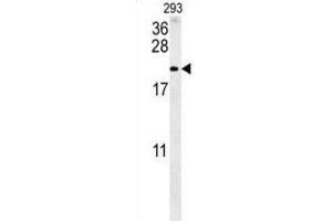 Western Blotting (WB) image for anti-Tachykinin, Precursor 1 (TAC1) antibody (ABIN3002474) (TAC1 Antikörper)