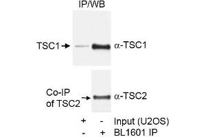 Immunoprecipitation (IP) image for anti-Tuberous Sclerosis 1 (TSC1) (C-Term) antibody (ABIN7449615) (TSC1 Antikörper  (C-Term))