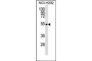 Western blot analysis using SFRS11 Antibody (C-term) Cat. (SRSF11 Antikörper  (C-Term))